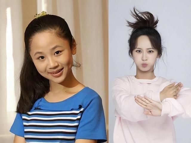 天生丽质|脸颊凹陷，鼻子透光，明显是整过脸，还嘴硬说天生丽质，打小这样