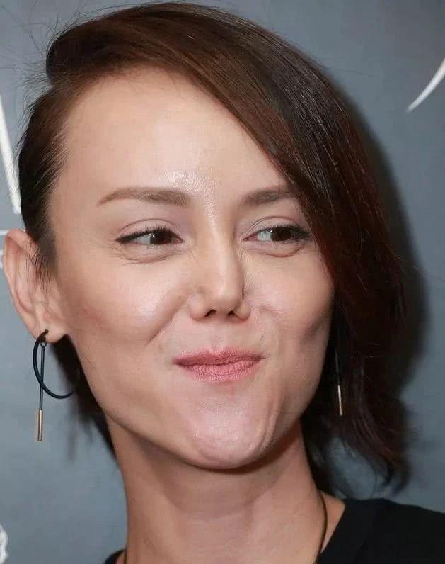 厌食症 减肥不当有何后果？这7位明星有人得了厌食症，有人得了暴食症