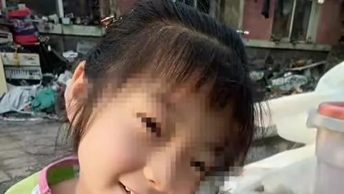 9岁女童被13岁男孩追砍20刀，缝200余针险些丧命，警方：无法追责。