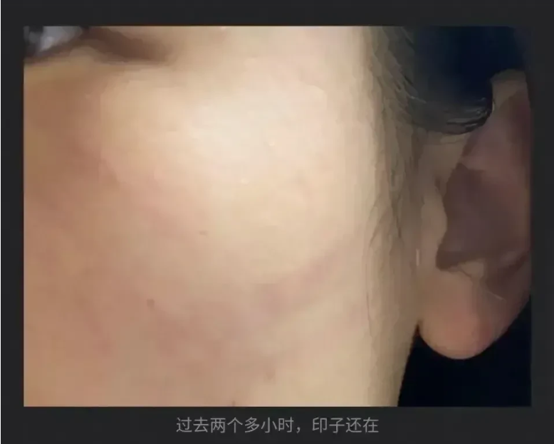 女孩在饭桌上与父母谈起“唐山打人案”,结果被父亲扇了一耳光。