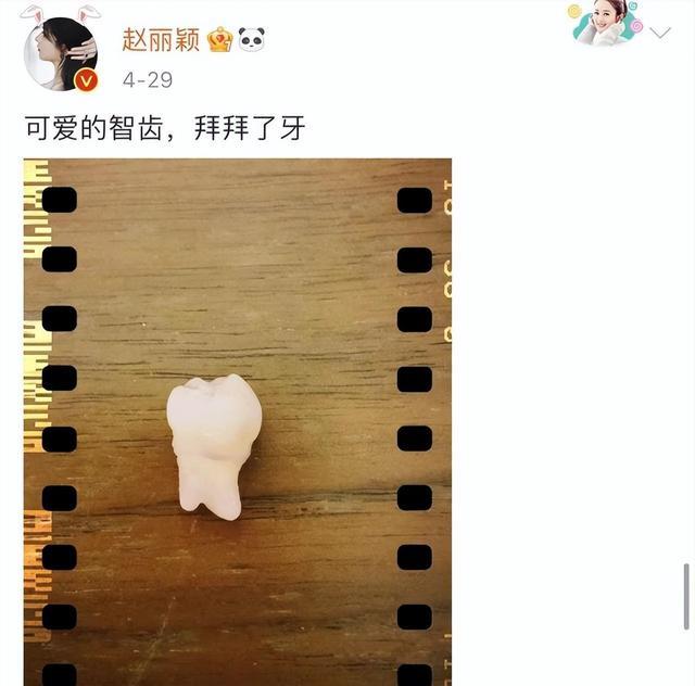 赵丽颖|赵丽颖近况惹争议，张嘴困难疑似整容失败