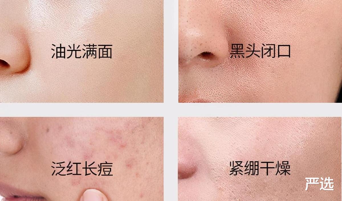 洗面奶 脸上刚“打湿”就涂洗面奶，难怪洗完也出油，皮肤越来越粗糙