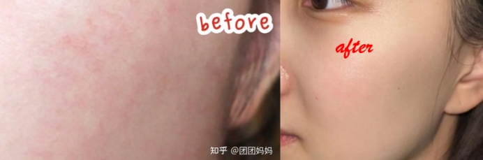 熊黛林 护肤品越贵越好？宝妈：孕期护肤品这样选，省钱省力还安全