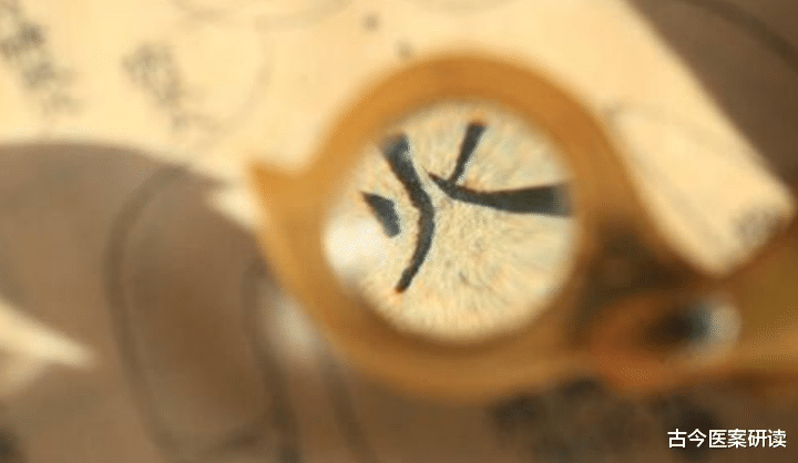 老中医|牙病患者的“福音”,老中医揭示一传统药方,再也不用拔牙了