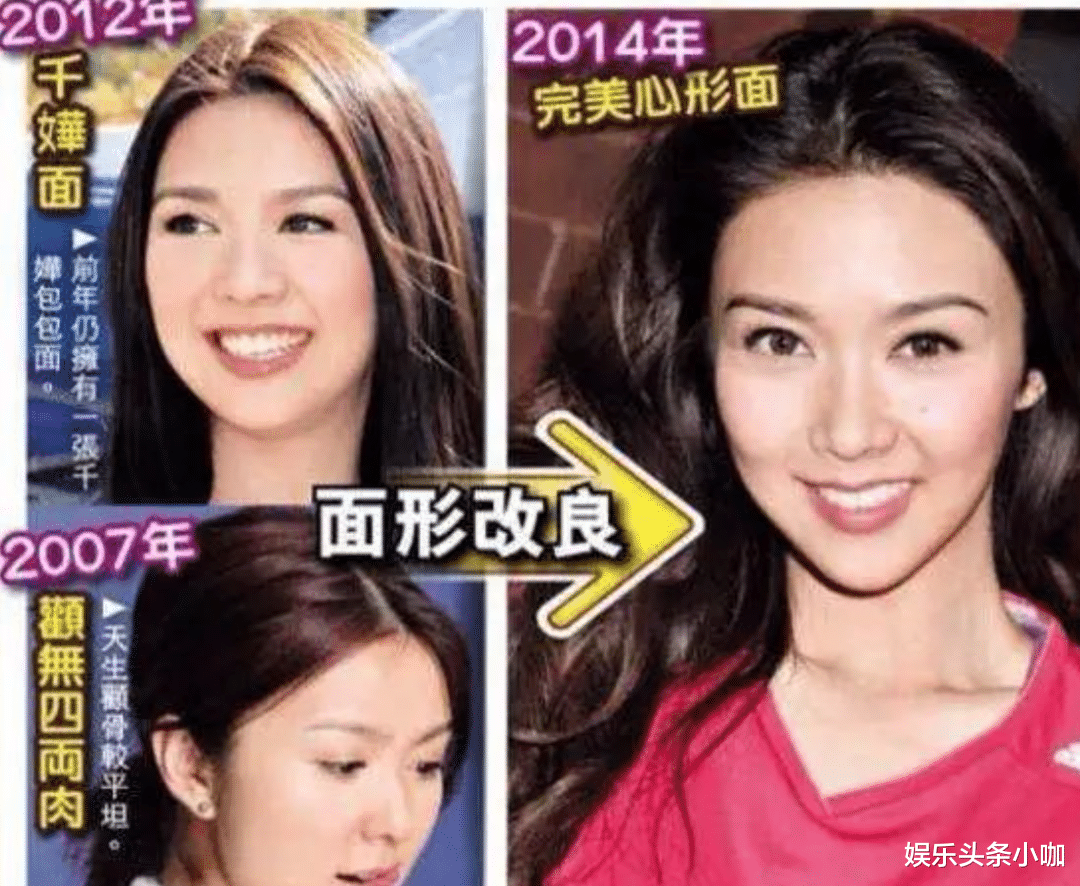 薛凯琪|她美的不可方物，却陷整容绯闻，还因口无遮拦闯祸？