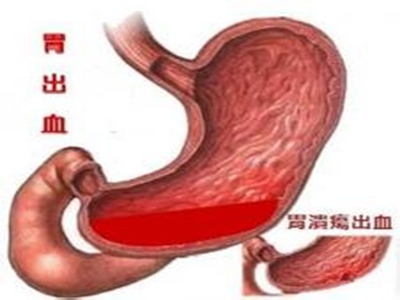 衰老|长期慢性出血，血虚肢冷面萎黄？送你一方，补肾健脾，治各种出血