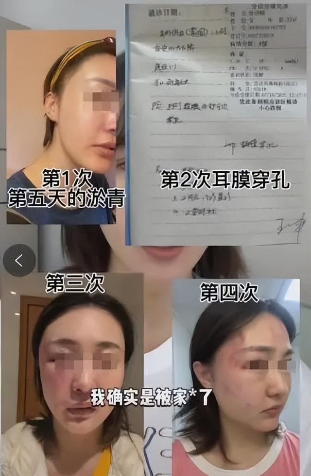 徐大宝|34岁女星被小5岁老公家暴，男方表示女方花式出轨，实在忍无可忍