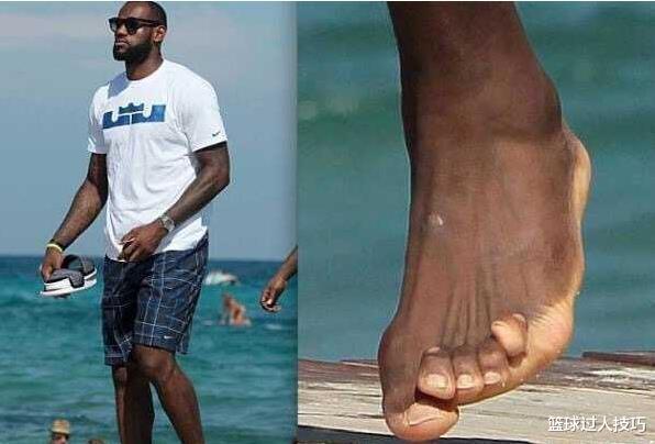 勒布朗·詹姆斯|看了詹姆斯脚趾、马龙白发、罗斯膝盖，你还羡慕NBA球星高薪吗？