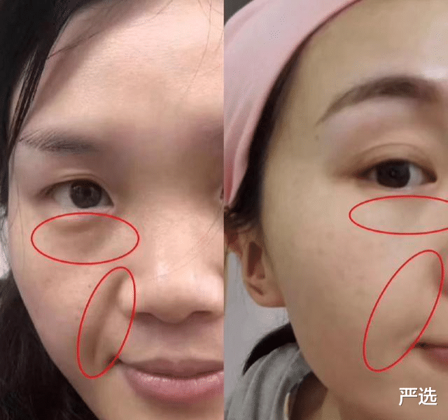 克丽缇娜 药店有一种不起眼的“精华液”，用后色斑皱纹全没了，堪称平价兰蔻！