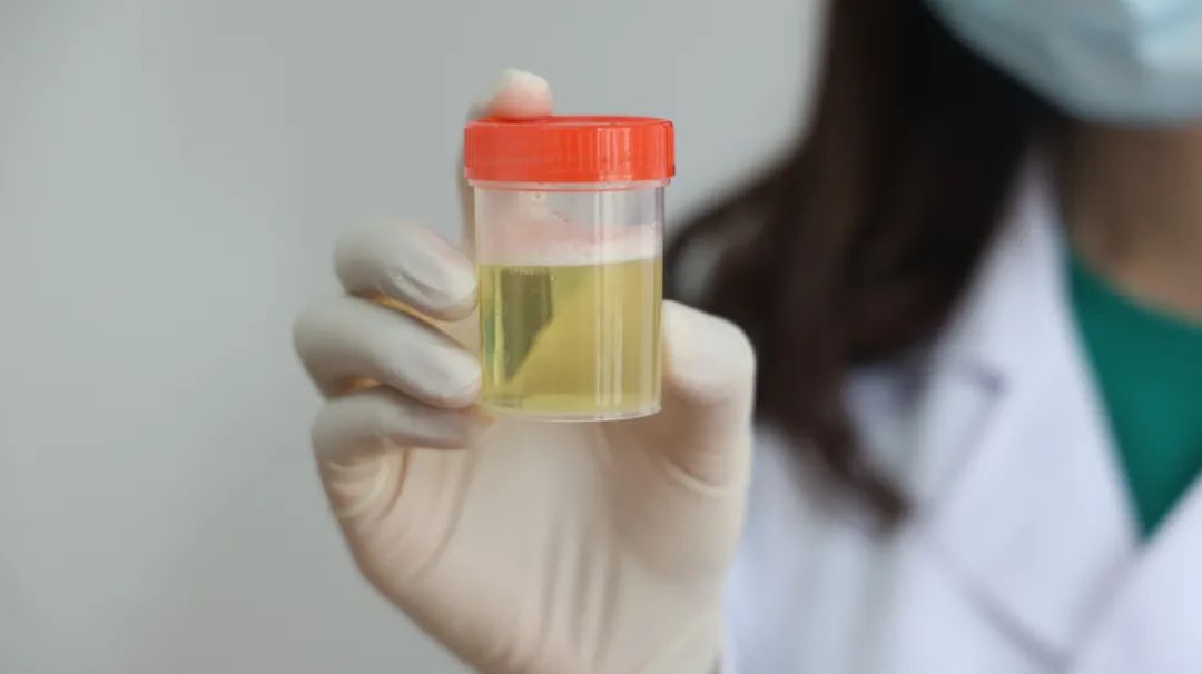 |肾脏好的人,身体往往有3个表现,如果全都占,值得恭喜