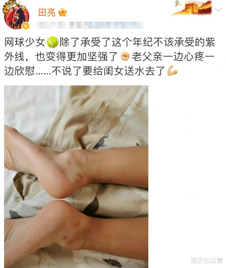 田雨橙|田亮回应森碟做职业网球手,14岁手臂肌肉发达,脚踝照令人心疼