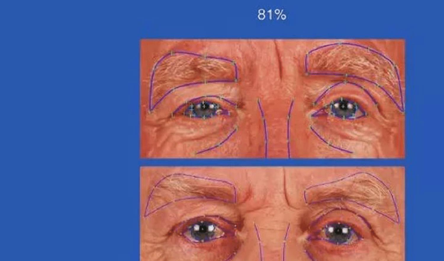 林永健|看了林永健和他“女儿”，才知道基因组合的强大，就像复制粘贴