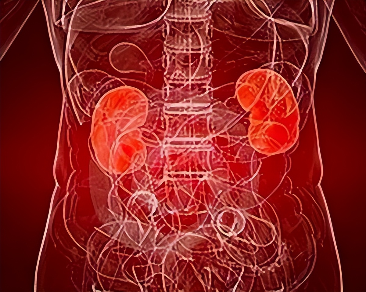 穴位|一剂中药多用法，半夏厚朴汤不仅化痰行气，还能搭配用于这4种病