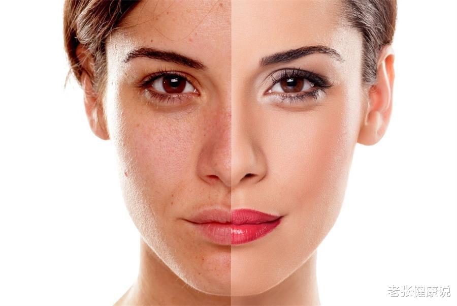 维生素E|巧用维生素E,助你告别斑斑点点,年轻5岁或不是梦