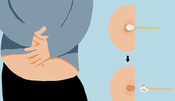 肠胃|肚脐眼又“黑”又“脏”,可以用手抠吗?看完肚脐连接哪就知道了