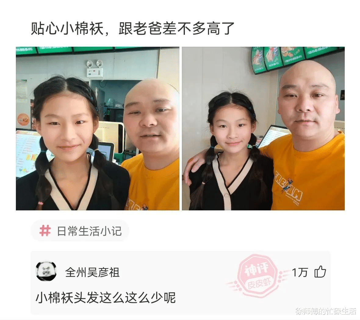 手套 “染头发的时候忘记戴手套了，怎么洗不掉...”这是幕后黑手？
