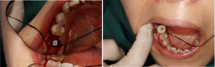 aiot|3D打印在口腔领域上的应用会在未来有明显的体现吗?