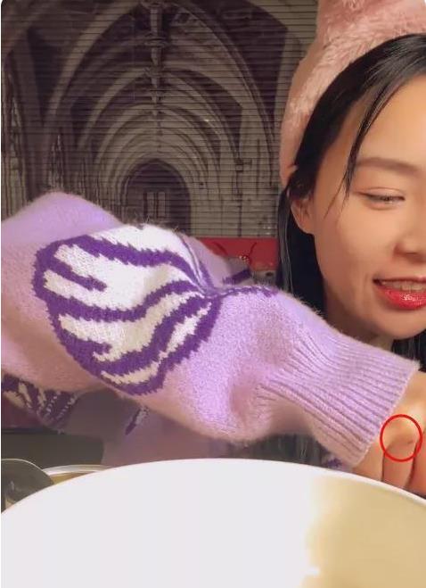 大胃王小贝状态不佳,手指现伤疤被网友质疑催吐,晒律师声明回怼