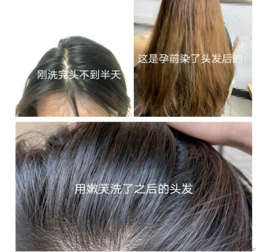 氨基酸 真心建议！孕期洗发水少听点商家噱头！选洗发水主要看2点