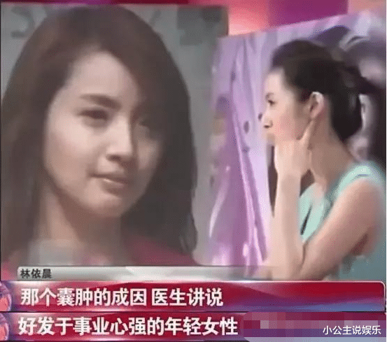 林依晨|她才是“小龙女”第一人选，因太红不想演，结果古装剧接连翻车