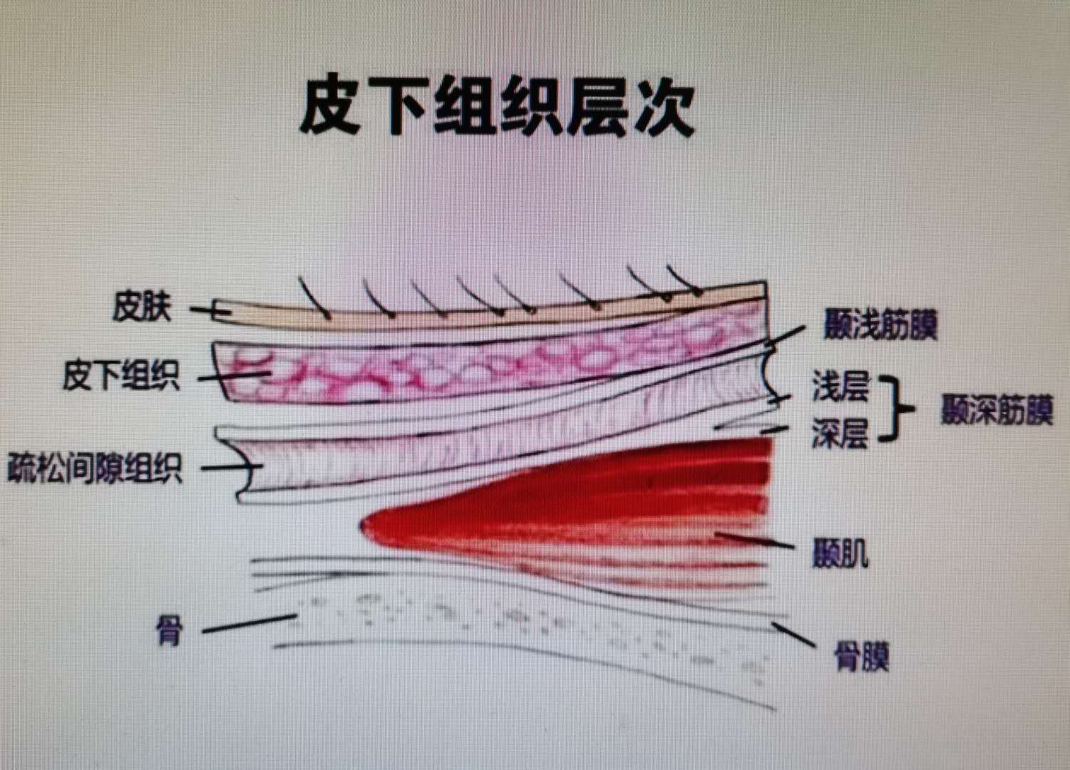 按摩|中医治疗筋膜炎的真实案例。