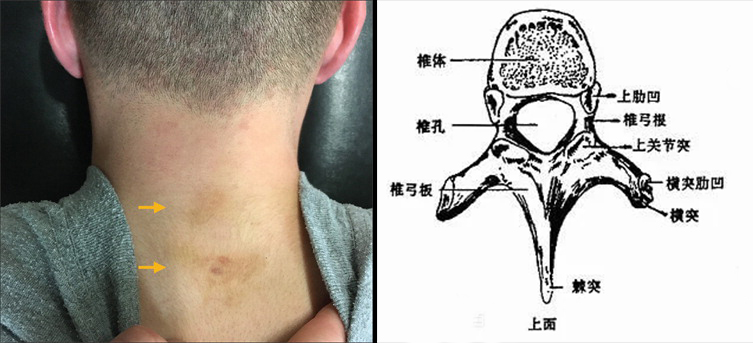 假如你全身骨头都被抽走,会发生什么?是进化成蠕虫,还是死亡?