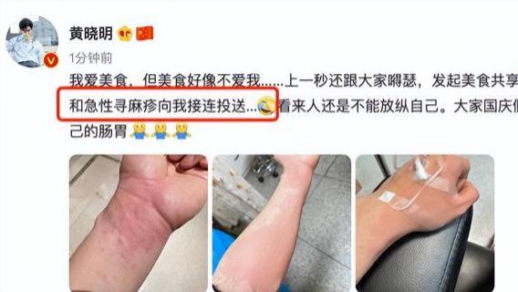 黄晓明|黄晓明急性肠炎住院，路边大排档放纵过度，手臂红肿太吓人！