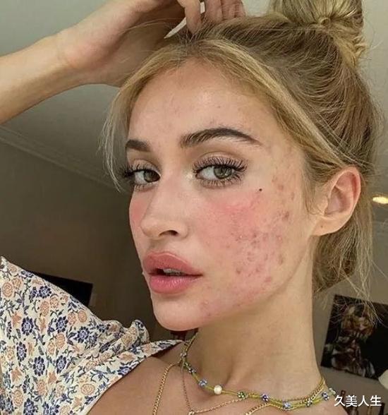 黑色素 去年美白又翻车了?点进来补课!