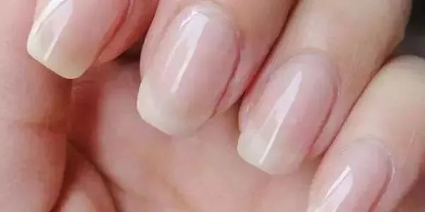 牙齿|皮防科普 | 指甲上的月牙、竖纹代表什么？