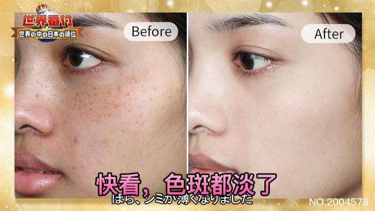 |精华液直接就往脸上抹？难怪你的皮肤会变差，这样做才是正确方法