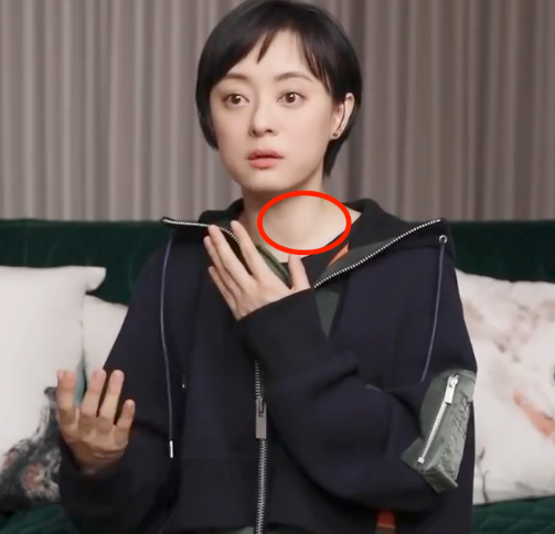 孙俪|?邓超近照暴瘦五官大变样，孙俪也眼凸脖子鼓，这对夫妻到底怎么了？