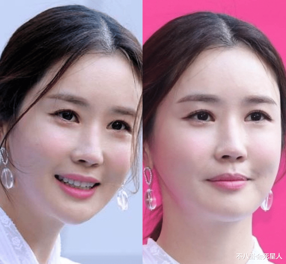 整容|那些红极一时的韩流明星，整容整得面目全非，动脸后遗症太可怕