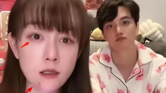 张檬|张檬带伤直播疑被家暴！眼肿有淤青小五态度不屑，结婚不到3个月