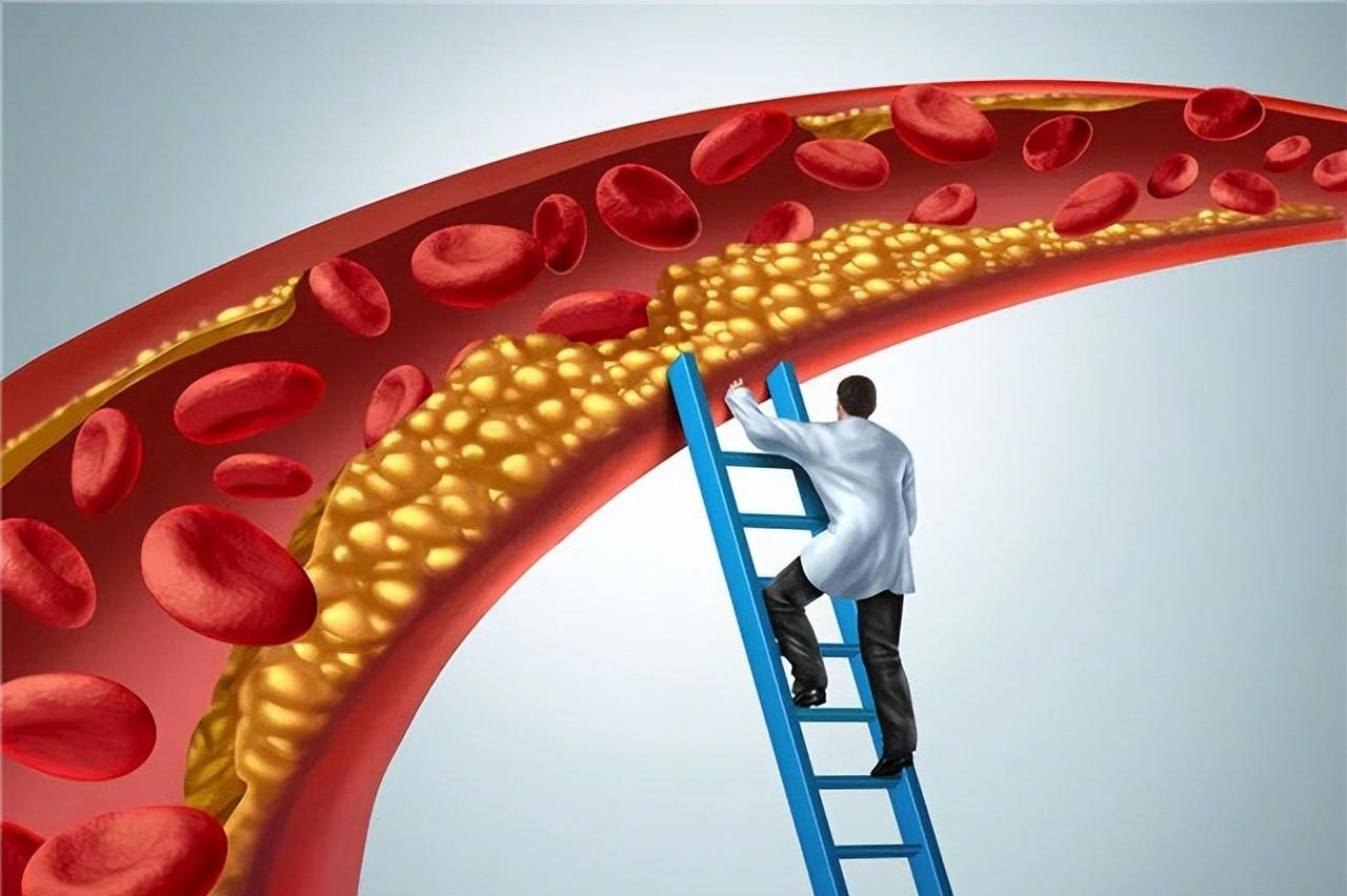 肾衰竭|58岁张叔查出慢性肾衰竭,原因:擅自将辛伐他汀换成瑞舒伐他汀
