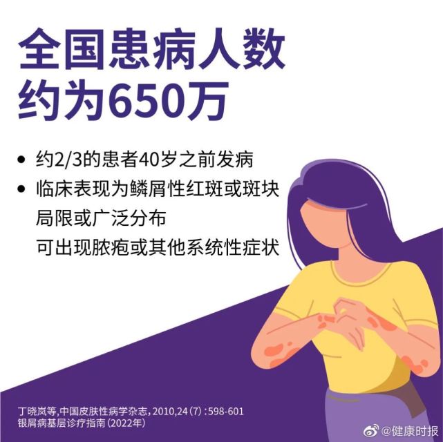 银屑病|皮防科普丨花费您3分钟的时间，请一定要了解银屑病