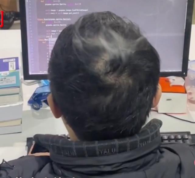 显示器|程序员写代码时头顶“冒烟”,认真工作毫无察觉,网友:太烧脑了