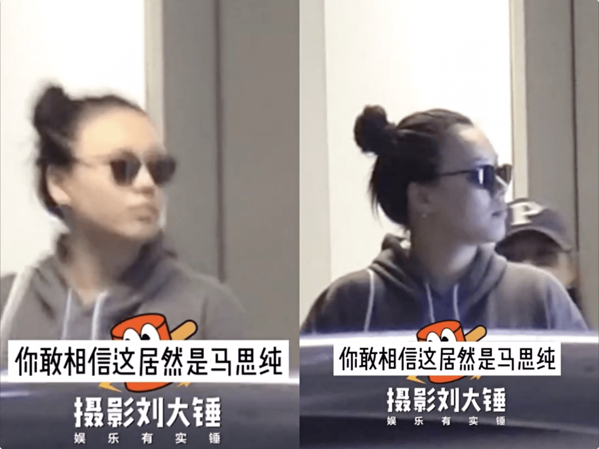 防晒衣 马思纯扎丸子头发际线上移，被网友质疑产后脱发