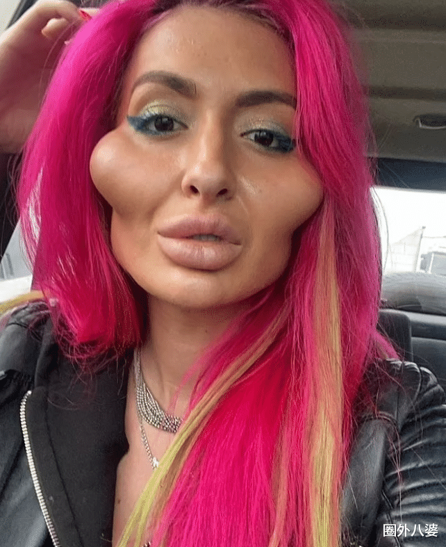 美容|这个动手术打造\世界最高颧骨\的女人，再次向自己的颧骨下手了