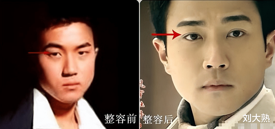 整容|6位明星“换头改命”,孩子却跟他们整容前一样,基因骗不了人