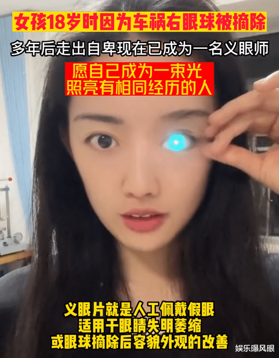 “眼睛发光”女孩昕瞳走红!18岁因车祸失去右眼,下楼梯经常踩空