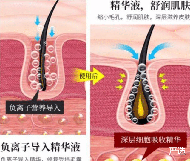 何超琼|姜文、于正拿她没辙,暴起来整个娱乐圈陪她炸!却为美容受900针