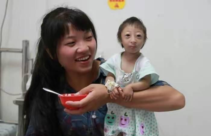 湖南女子生下“小猴子”,杂技团开价5万想买走,如今她现状如何
