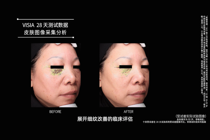 甲状腺癌|这几种东西补对了，真能老得慢一点