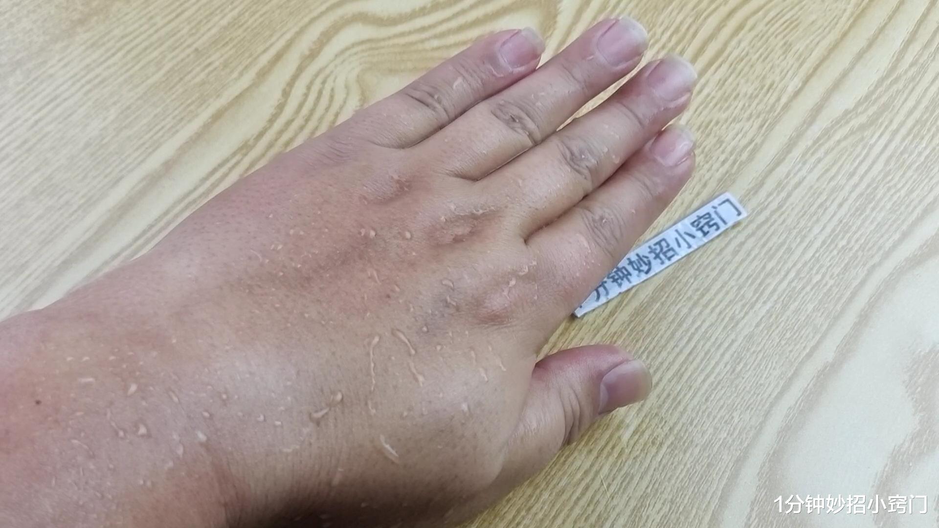 红糖|双手粗糙又难看？教你小妙招，让你的双手白皙光滑细腻，简单有效