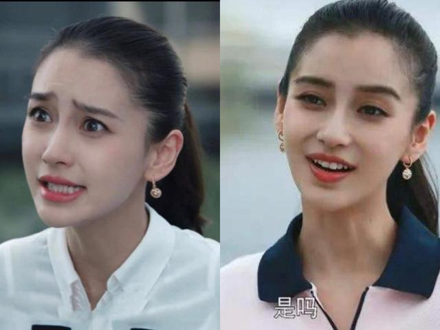 整容 明星整容后遗症:“一刀削”脸僵挂不住肉,演戏五官乱飞,没眼看