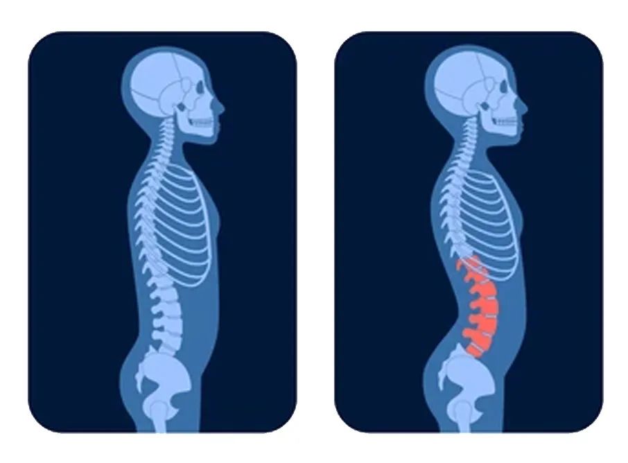 |久坐危害有多大?坐多久才算久坐?看完你就明白了!