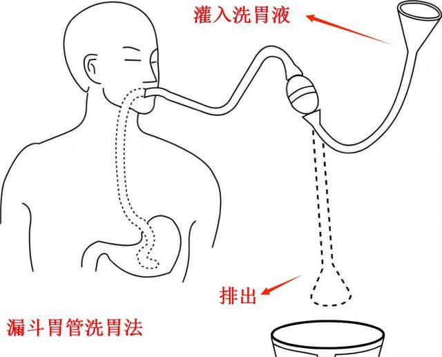 虹吸原理:世界上伟大的发明之一,解决了人类厕所的卫生问题