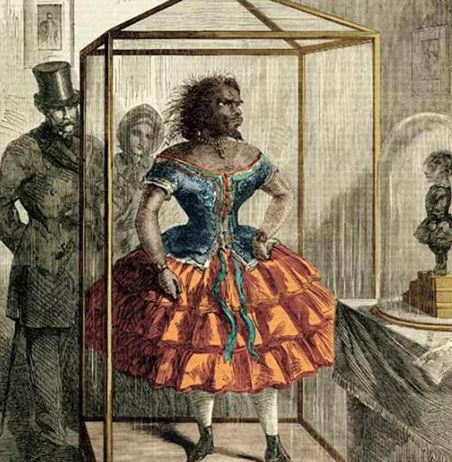 斯特拉|朱丽亚:因长相丑陋被丈夫送进马戏团,死后还被制成标本展览