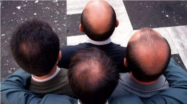 心肌梗塞|男人开始“衰老”时，通常会有3个表现，若占一个，该注意保养了