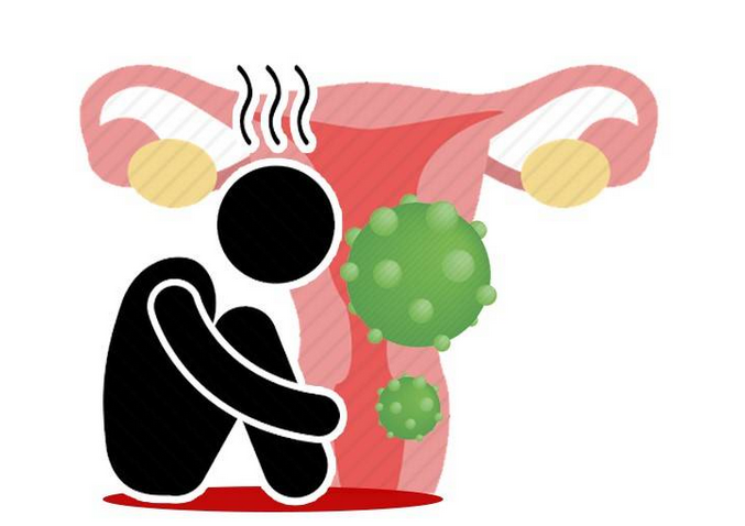 盆腔炎|年纪轻轻就腰痛?女性经常腰痛,除了坐姿不对,可能与4种病有关